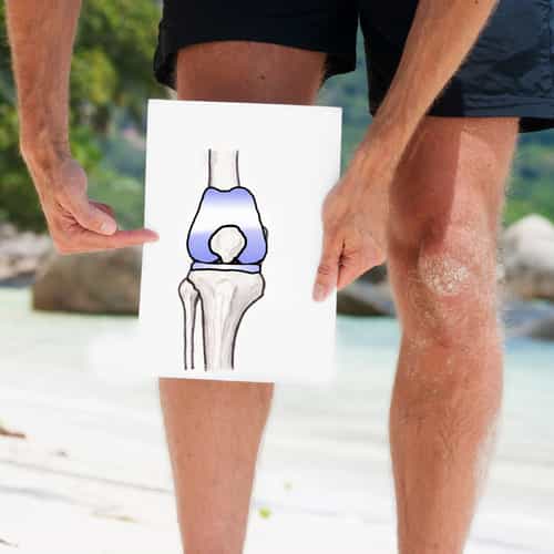 Advanced Knee Surgery in Tijuana, Mexico for Arizona Residents